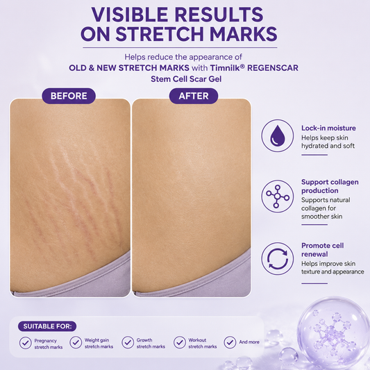 Timilk® REGENSCAR Stem Cell Scar Gel