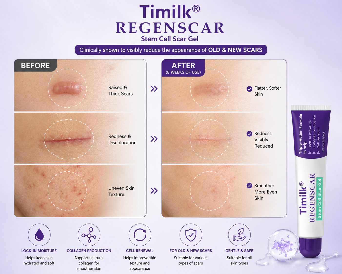 Timilk® REGENSCAR Stem Cell Scar Gel
